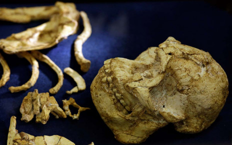 ‘Little Foot’ hominin was either ill or very hungry in her childhood