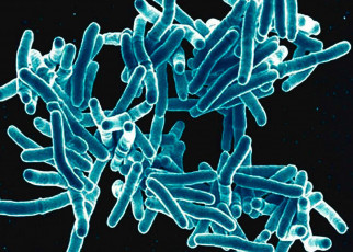 People of European descent evolved resistance to TB over 10,000 years