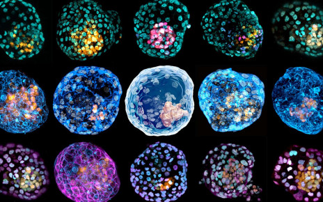 Human skin cells altered to mimic early stage of embryo development
