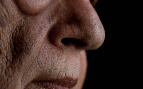 Early signs of Parkinson’s disease could be spotted in the nose