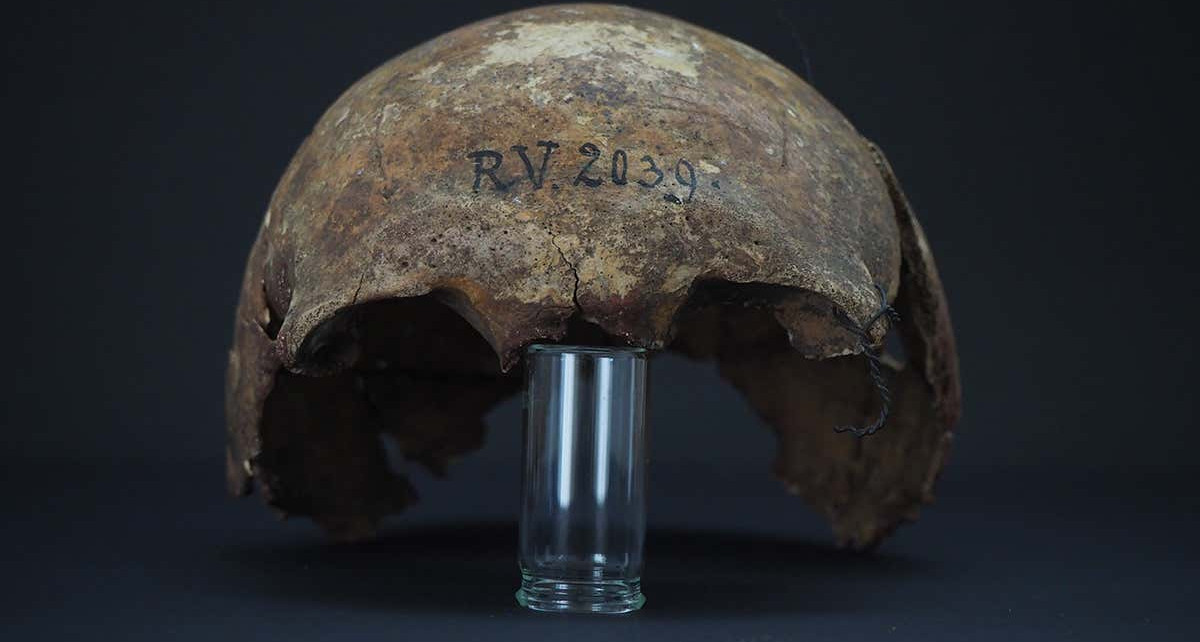 Earliest known bubonic plague strain found in 5000-year-old skull