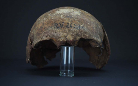 Earliest known bubonic plague strain found in 5000-year-old skull
