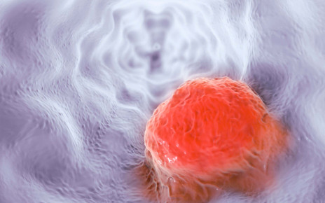 Most cancers of the oesophagus are caused by escaped stomach cells