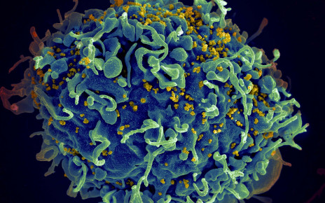 ECF1N3 Scanning electron micrograph of HIV particles infecting a human H9 T cell.