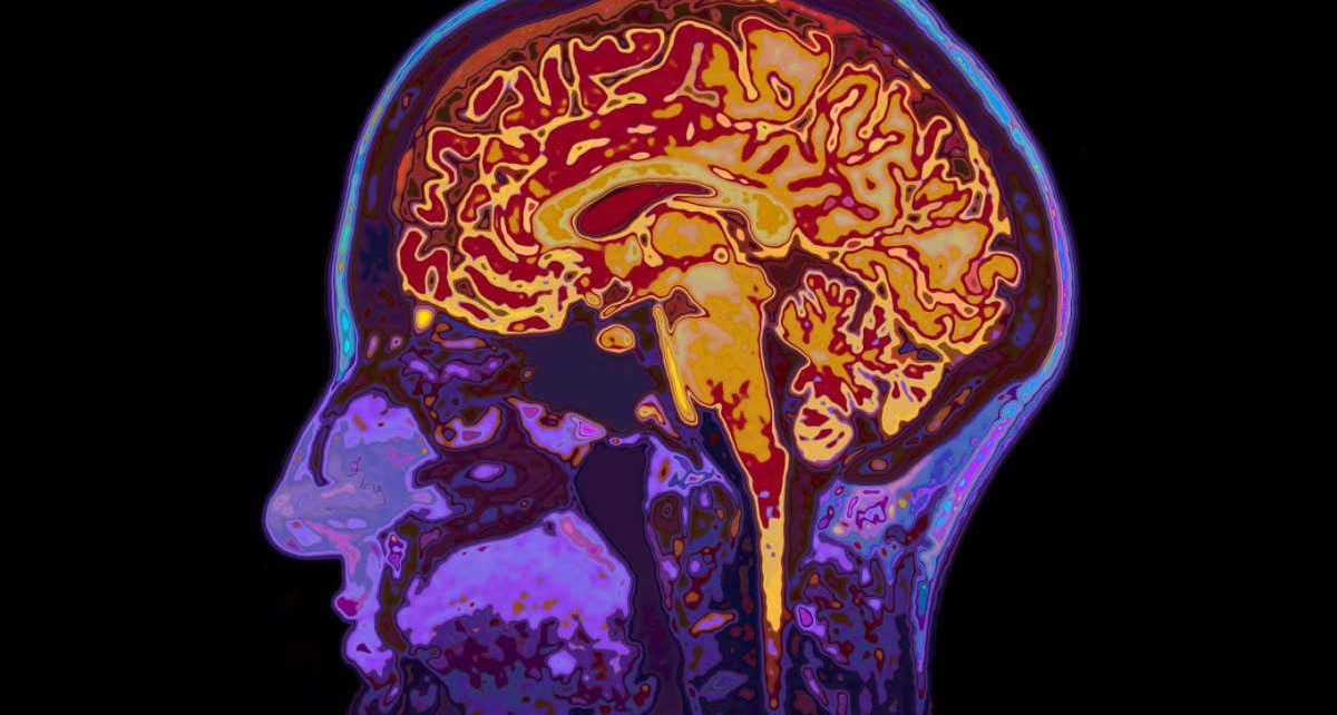 MRI has been used to reveal epigenetic changes in brain for first time