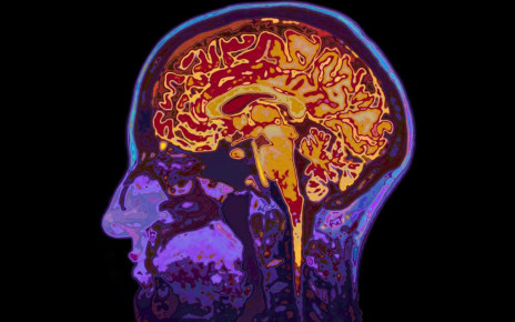 MRI has been used to reveal epigenetic changes in brain for first time