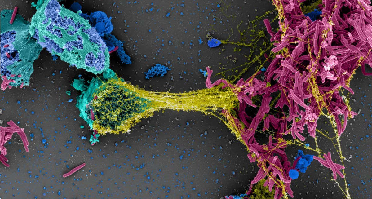 Our web-slinging immune cells caught in action for photo contest
