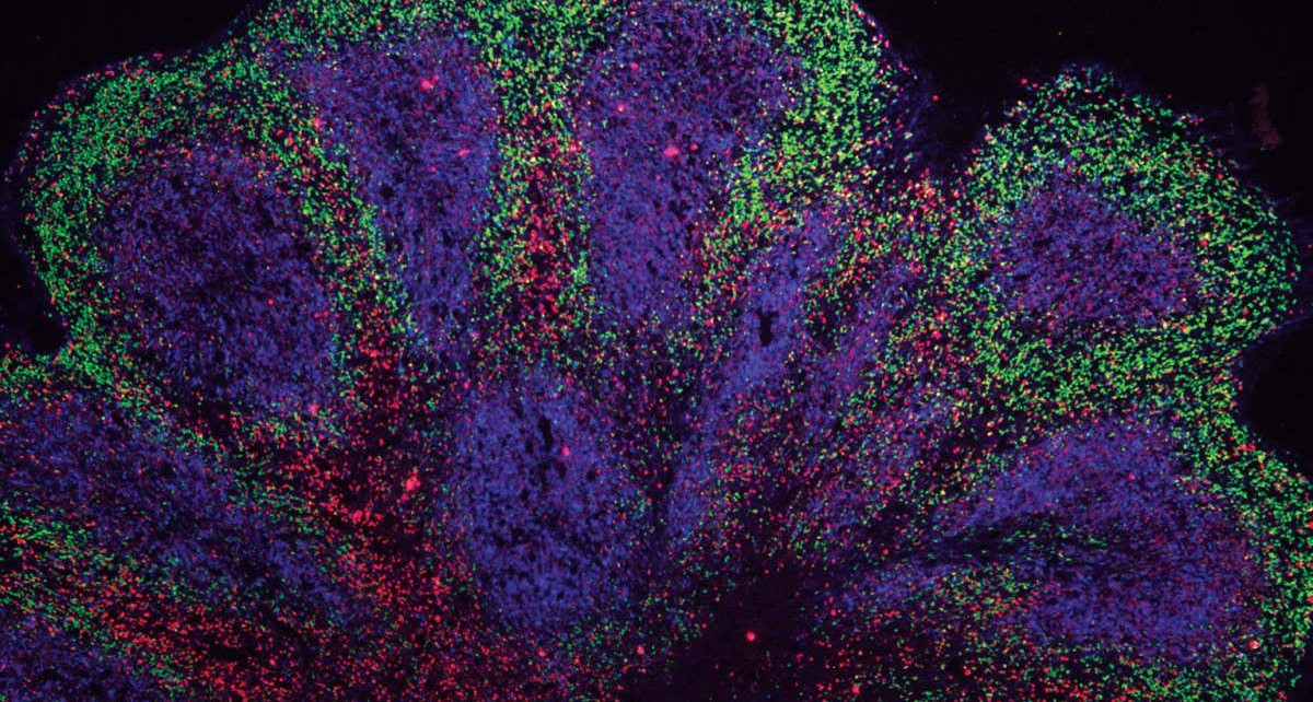 Human brain: Lab-grown mini versions kept alive for a year
