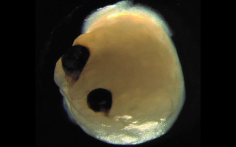 A brain organoid with eye-like optic cups Elke Gabriel