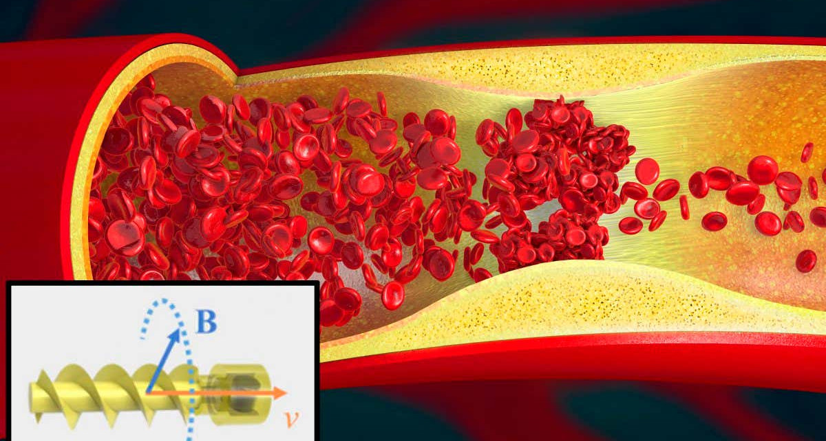 Corkscrew-shaped robot swims through blood and delivers thrombolytic drugs