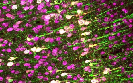 Genetically altered brain cells in mice can be controlled with ultrasound