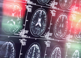 Sneaking drugs into the brain could treat conditions like Alzheimer's