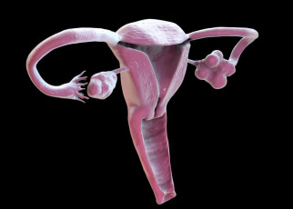 Polycystic ovary syndrome, 3D illustration showing healthy ovary (right) and enlarged ovary with cysts (left); Shutterstock ID 2031203066; purchase_order: -; job: -; client: -; other: -