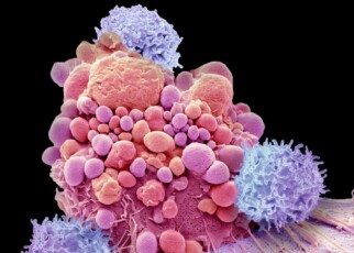 Immunotherapy: The CAR T-cell therapies that are curing cancer