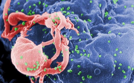 Third person 'cured' of HIV after receiving stem cell cancer treatment