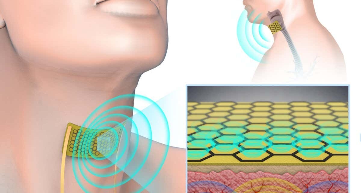 Tiny throat mic can detect and broadcast silently mouthed words