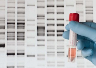 Polygenic risk score: DNA tests now on sale can predict your disease risk
