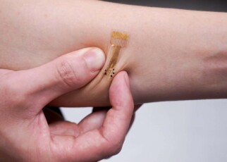 Electronic wound dressing releases drugs to help injuries heal