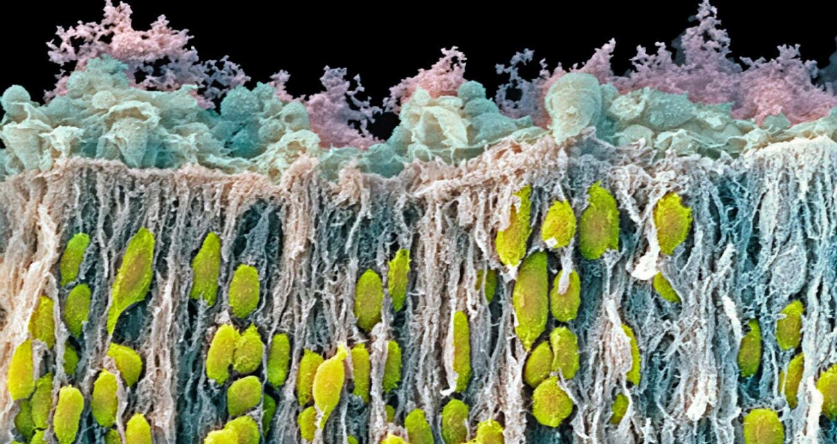 A scanning electron micrograph of neurons in the corpus striatum part of a foetal brain
