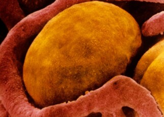 A scanning electron micrograph of a brown fat cell surrounded by capillaries