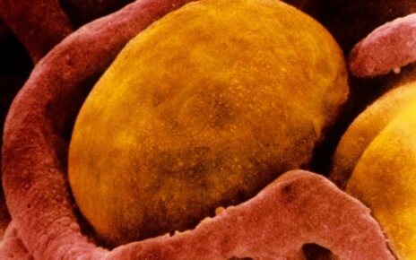 A scanning electron micrograph of a brown fat cell surrounded by capillaries