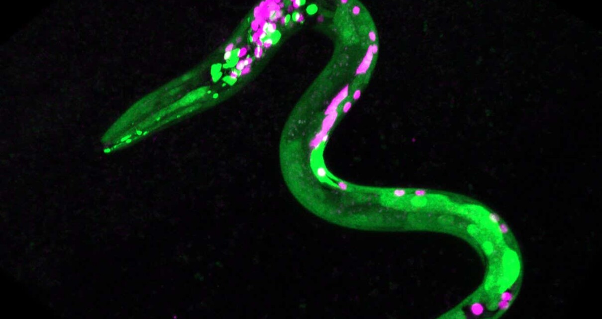 Image of a nematode worm