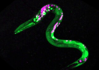 Image of a nematode worm