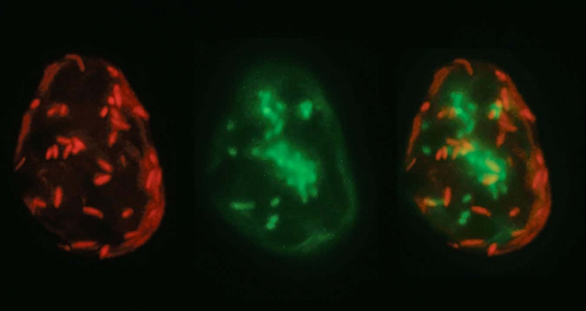 Evolutionary oddball has seven genomes inside a single cell