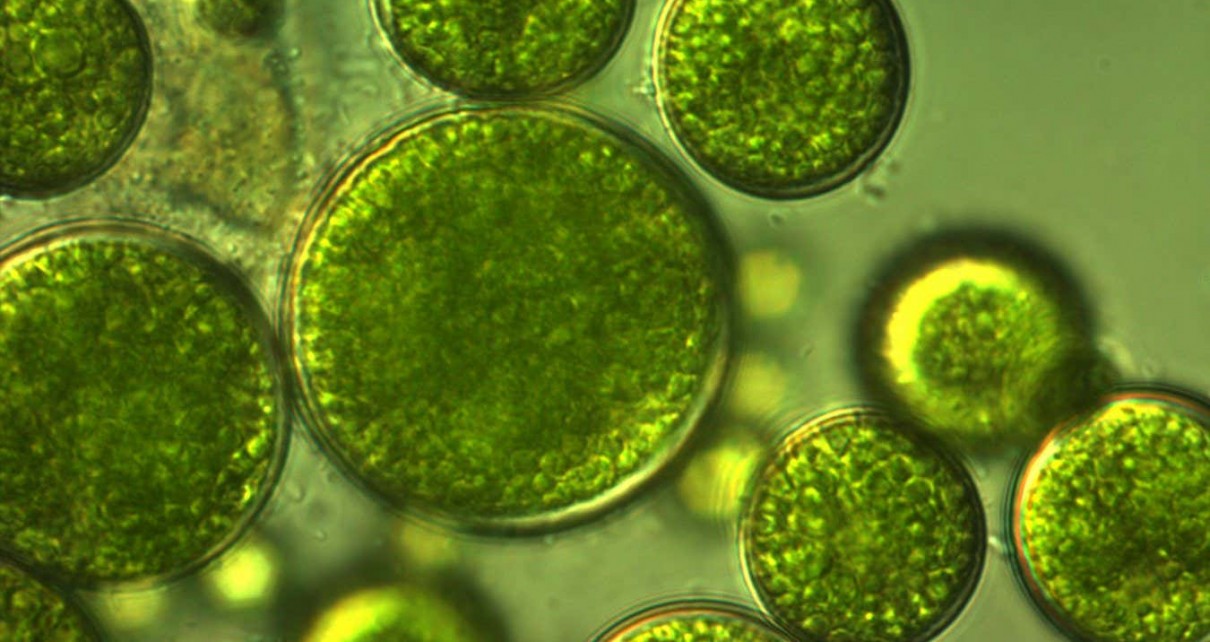 Unicellular green algae with large cells.; Shutterstock ID 1042159933; purchase_order: -; job: -; client: -; other: -