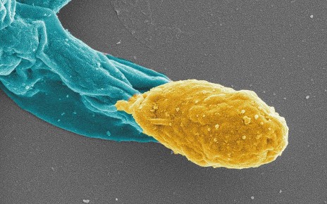 C. difficile spore in gold emerges from a bacterium in turquoise