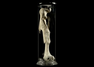 See the Hunterian Museum's weird and wonderful anatomical curiosities
