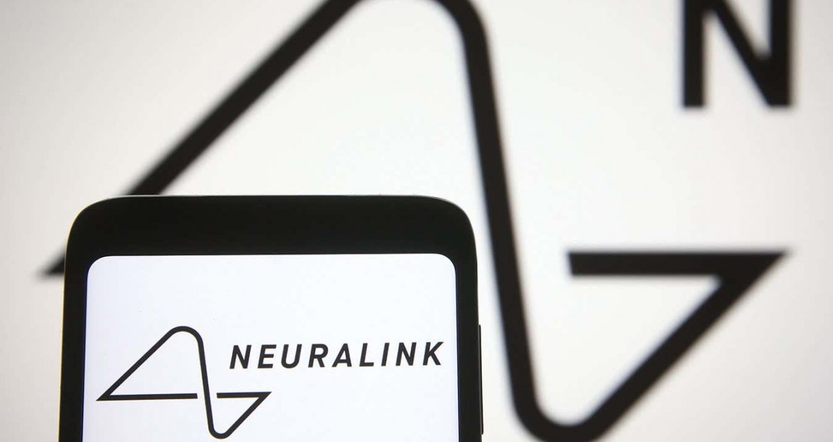 Neuralink says it has permission to conduct its first human trials
