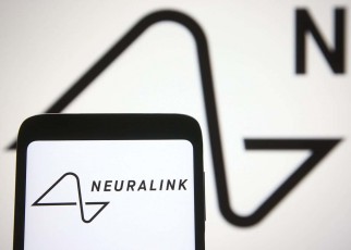 Neuralink says it has permission to conduct its first human trials