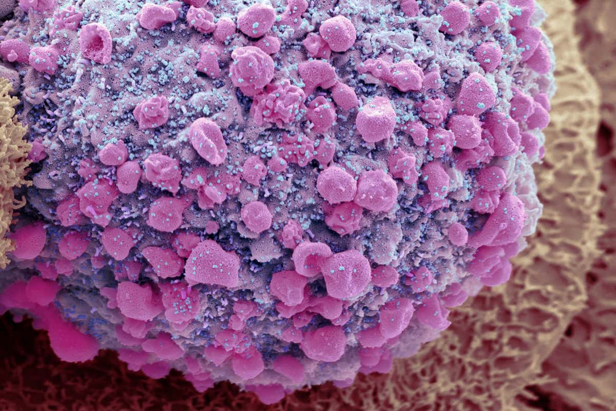 A scanning electron micrograph of the delta SARS-CoV-2 variant (pink dots) budding from a human gut cell