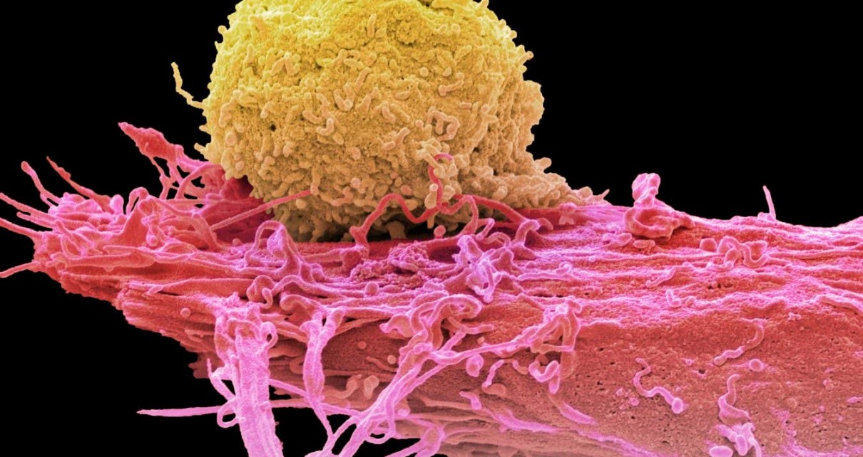 How cancer-fighting immune cells could be made safer and more powerful