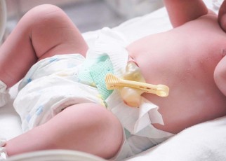 Umbilical cord blood could be used to predict childhood obesity