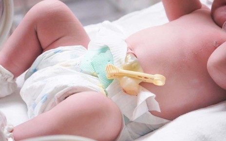 Umbilical cord blood could be used to predict childhood obesity
