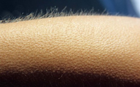 We are hopeless at telling when we have goosebumps