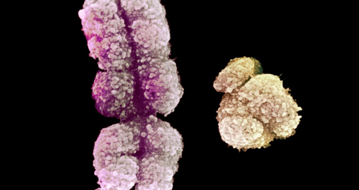 The human Y chromosome has been fully sequenced for the first time
