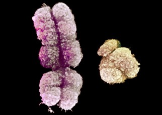 The human Y chromosome has been fully sequenced for the first time