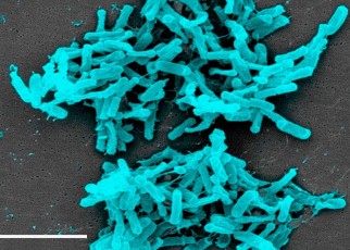 The Clostridium difficile bacterium can cause diarrhoea - and shorter people may be particularly at risk