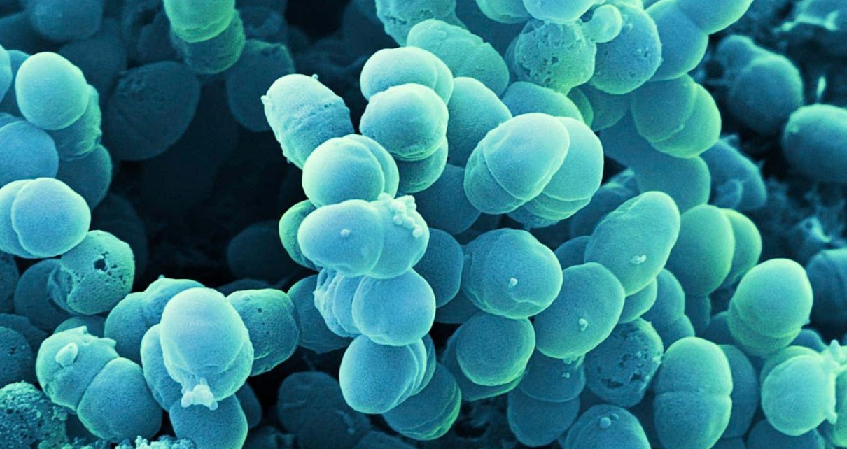 Levels of the bacteria Staphylococcus epidermidis may be higher in people with eczema than those without the condition