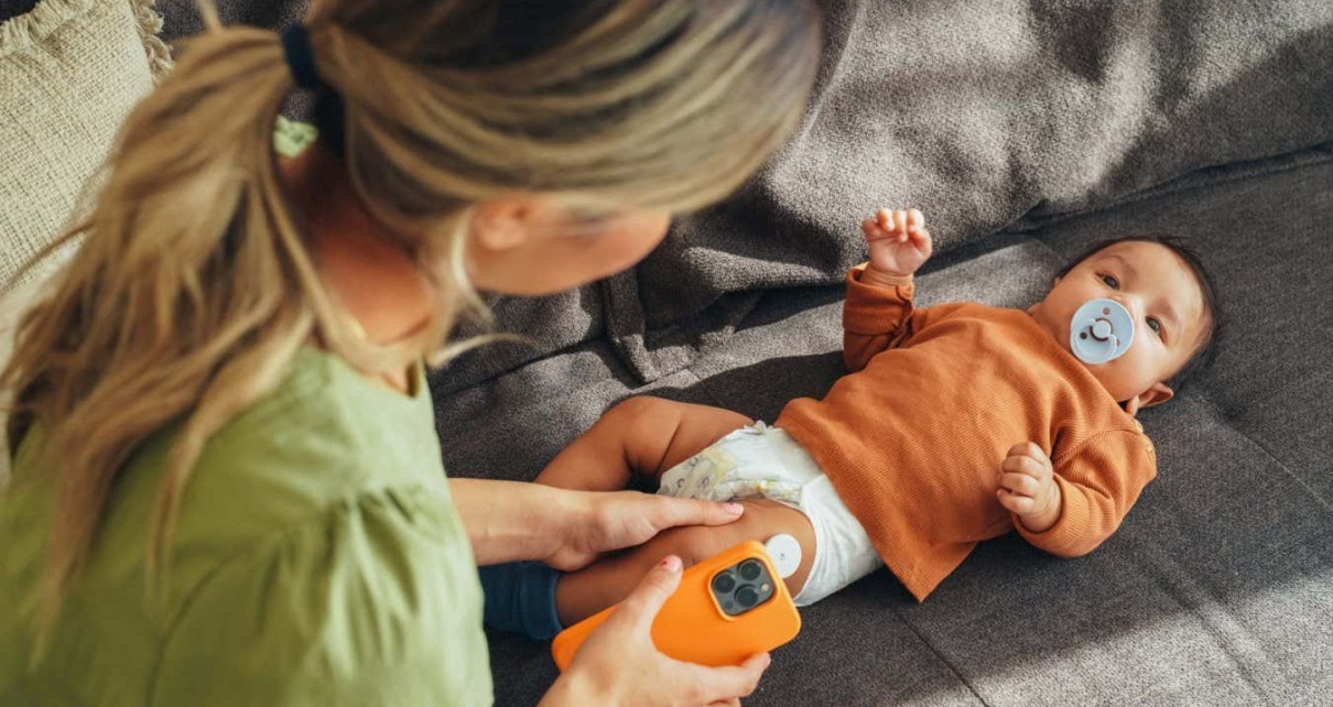 A baby wearing a sensor for measuring blood glucose levels