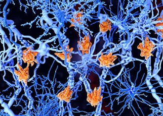 Vaccine that erases immune memory may help treat multiple sclerosis