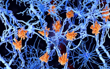 Vaccine that erases immune memory may help treat multiple sclerosis