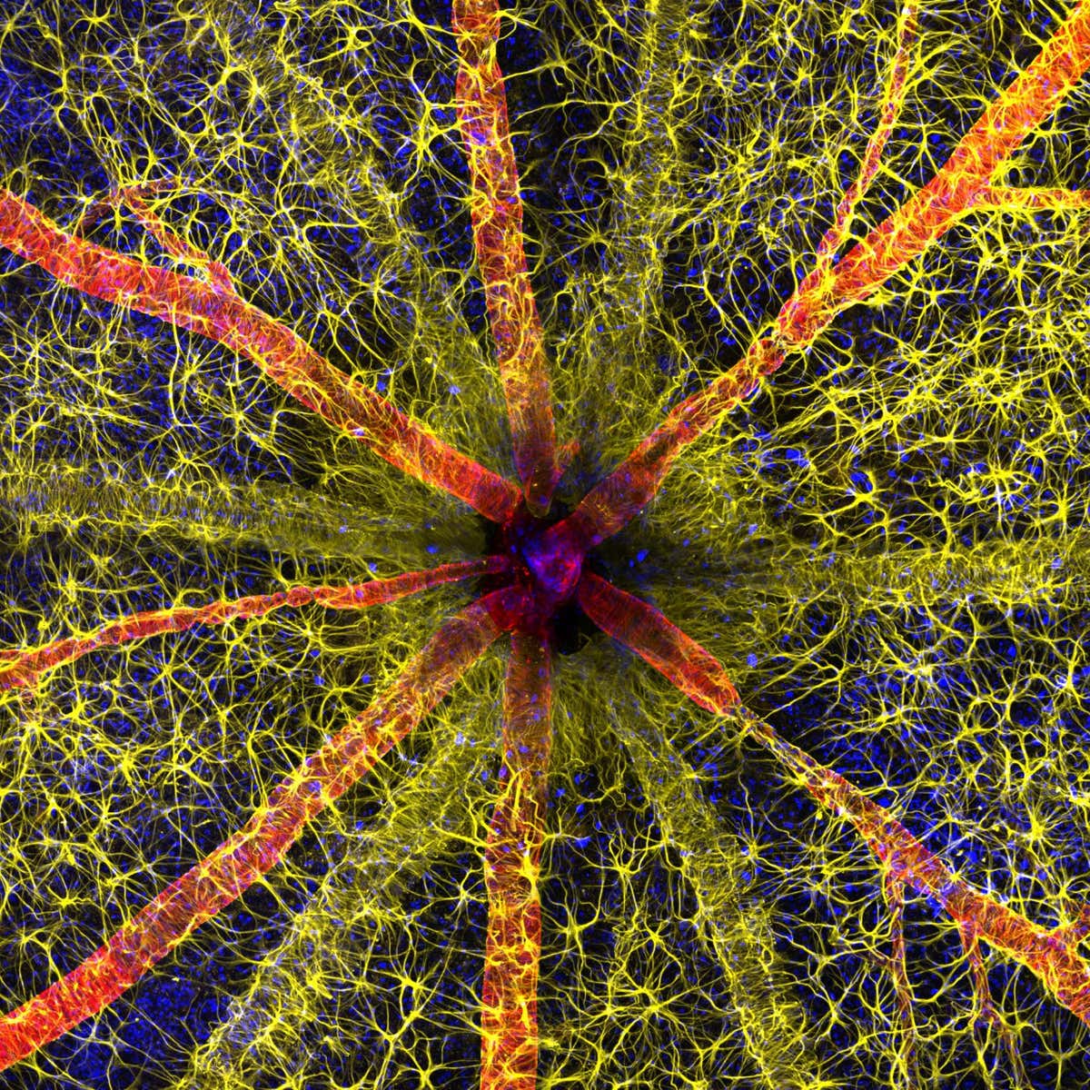 1st Place Hassanain Qambari & Jayden Dickson The Lions Eye Institute Department of Physiology & Pharmacology Perth, Western Australia, Australia Rodent optic nerve head showing astrocytes (yellow), contractile proteins (red) and retinal vasculature (green) Confocal, Fluorescence, Image Stacking 20X (Objective Lens Magnification)