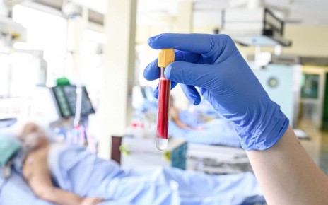 Simple blood test tweak could make intensive care treatment safer
