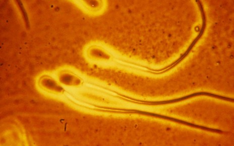 Scientists studied bull sperm, which have similar structures and swimming patterns to human sperm