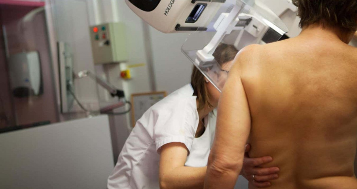 Anastrozole: Drug that cuts breast cancer risk set for wider use in UK