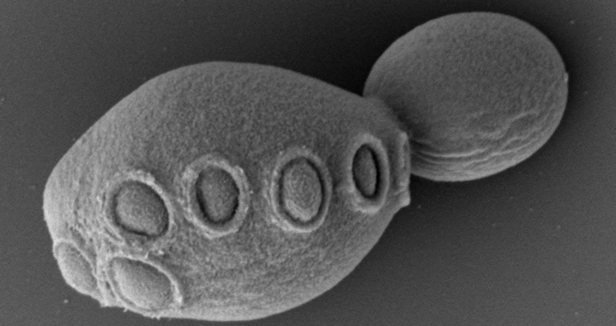 Yeast has half its DNA rewritten in quest for synthetic complex cells